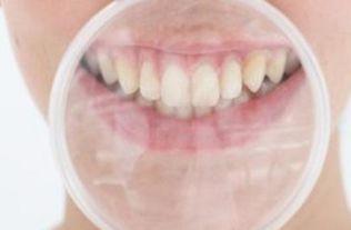 成人修磨牙视频大全图片,成人修磨牙技巧与案例图解